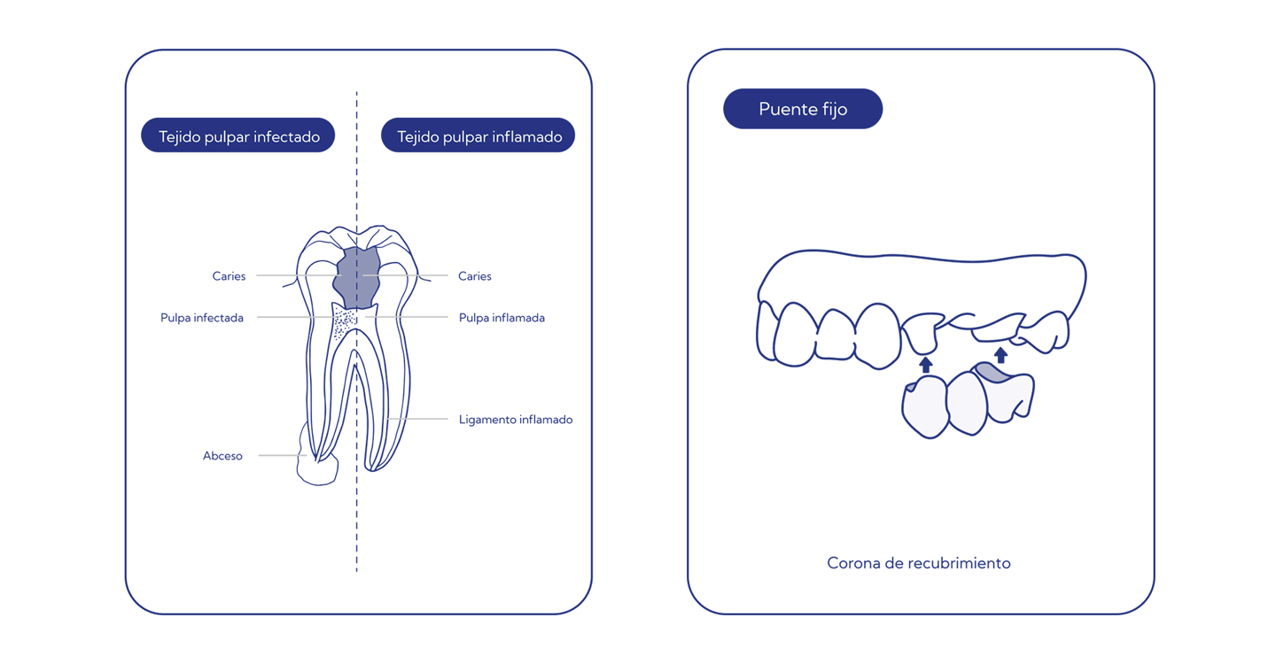 ilustraciones procesos dentales
